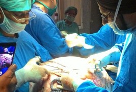توموری به وزن یک مرد بالغ در شکم یه زن +عکس